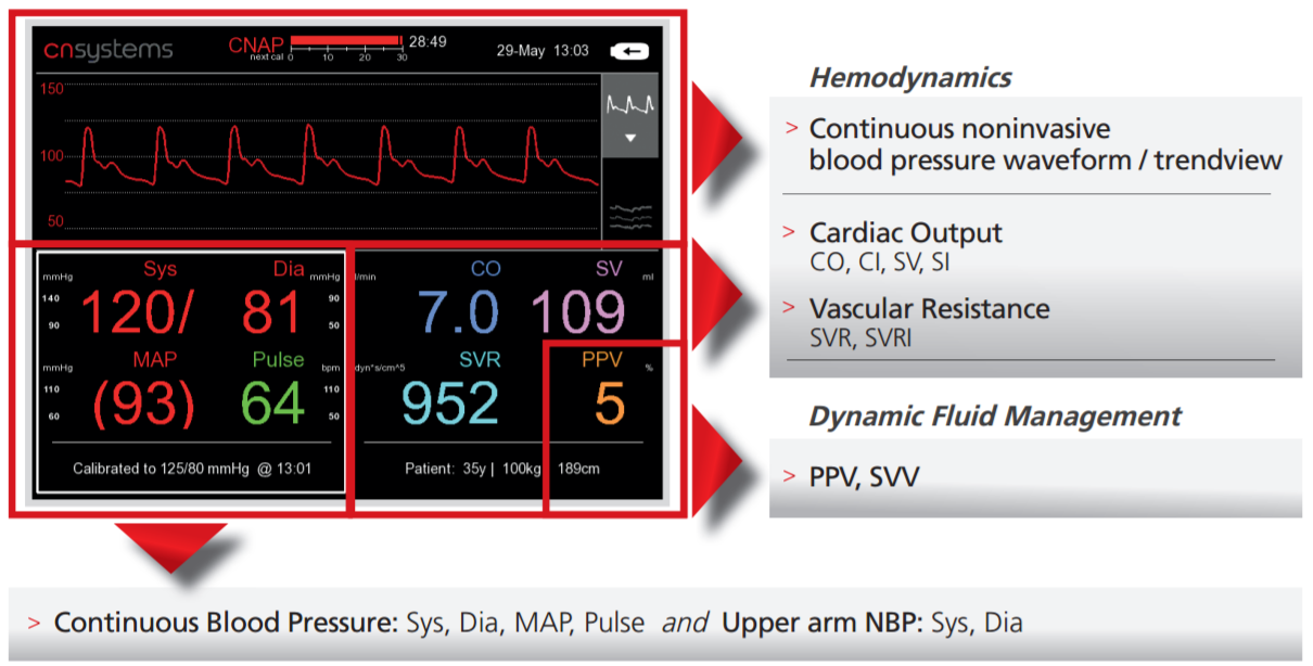 Continuous blood pressure patient monitor - CNAP® Monitor - CNSystems  Medizintechnik - cardiac output / NIBP / systolic pressure