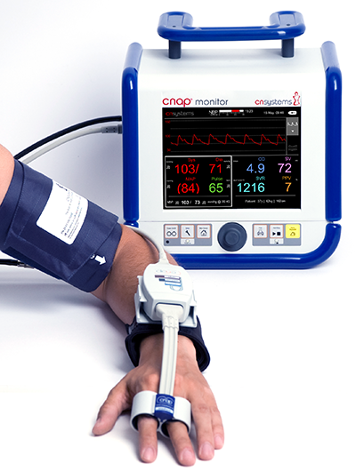 A Low-Cost Wristwatch for Non-Invasive Continuous Blood Pressure Monitoring